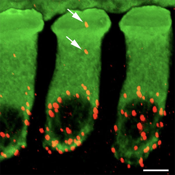 Synapses (red) connect inner ear hair cells (green) to the auditory nerve. The auditory nerve sends info about sounds to the brain. Drs. Isabelle Roux, Paul Fuchs, Elisabeth Glowatzki, Johns Hopkins Medicine